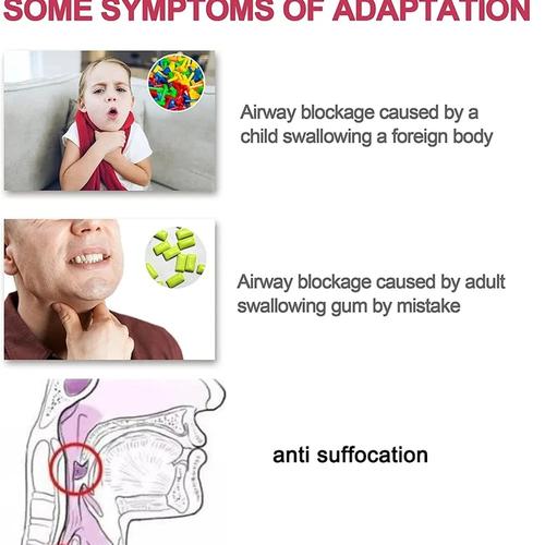 Choking Emergency Device